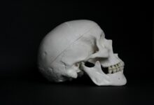 L'étude d'un crâne montre que les Egyptiens anciens tentaient de traiter le cancer.